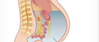 Асцит брюшной полости при онкологии лечение отзывы