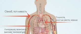 Диарея при беременности второй триместр