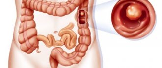 Endoscopic colon polypectomy