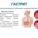 Gastroscopy