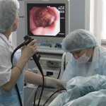 How is esophageal manometry done?