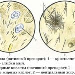 Как выглядит появление жирных кислот в каловой массе