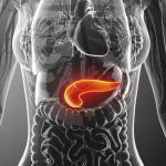 Treatment of pancreatitis after gallbladder removal