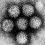 Rotavirus infection