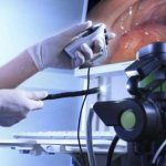 Sedation during colonoscopy: description of the method - News4Health.ru