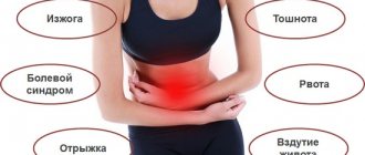 Symptoms of hyperacid gastritis