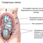 Тонус матки у будущей матери