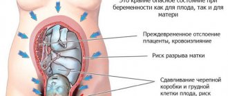 Uterine tone in an expectant mother