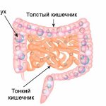 Вздутие живота, газообразование в кишечнике